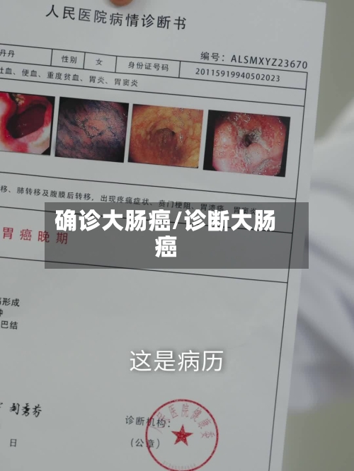 确诊大肠癌/诊断大肠癌-第2张图片