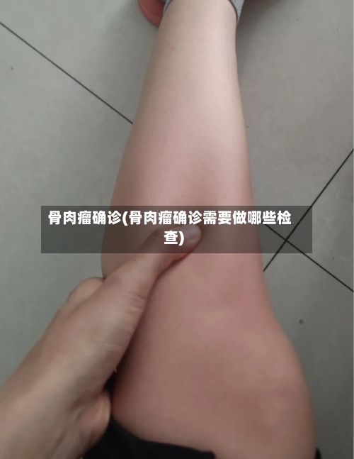 骨肉瘤确诊(骨肉瘤确诊需要做哪些检查)