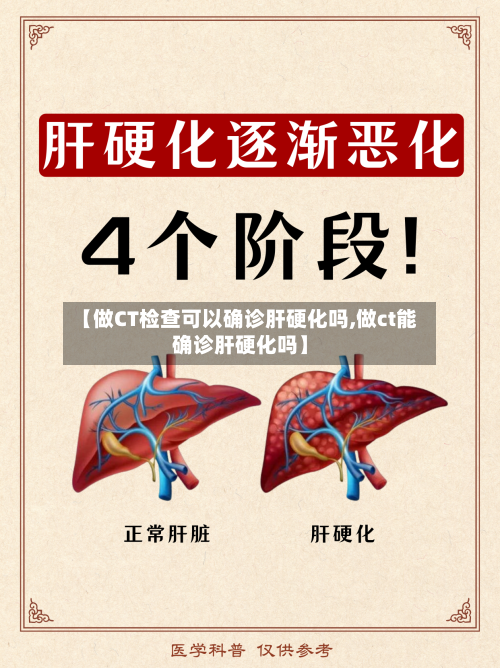 【做CT检查可以确诊肝硬化吗,做ct能确诊肝硬化吗】-第2张图片