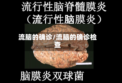 流脑的确诊/流脑的确诊检查-第2张图片