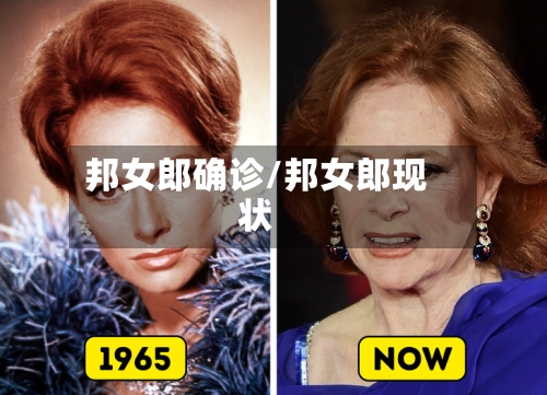 邦女郎确诊/邦女郎现状-第3张图片