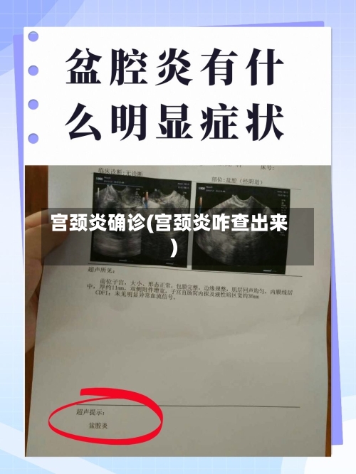宫颈炎确诊(宫颈炎咋查出来)