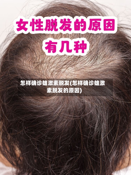 怎样确诊雄激素脱发(怎样确诊雄激素脱发的原因)-第3张图片