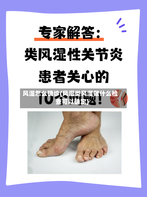 风湿怎么确诊(风湿类风湿做什么检查可以确定)-第2张图片