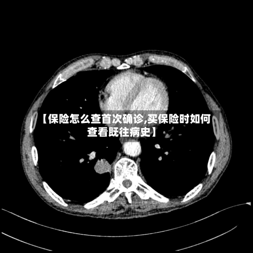 【保险怎么查首次确诊,买保险时如何查看既往病史】-第2张图片