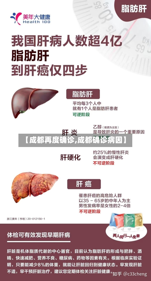 【成都再度确诊,成都确诊病因】