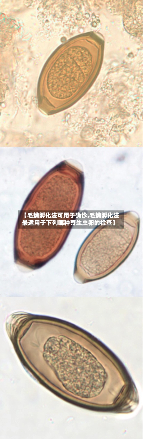 【毛蚴孵化法可用于确诊,毛蚴孵化法最适用于下列哪种寄生虫卵的检查】-第3张图片