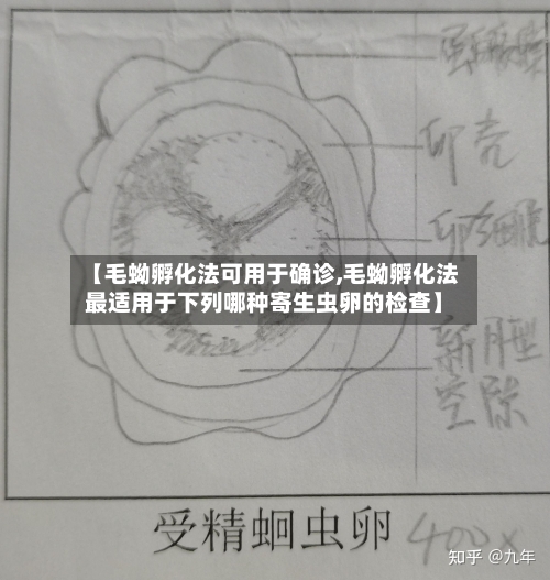 【毛蚴孵化法可用于确诊,毛蚴孵化法最适用于下列哪种寄生虫卵的检查】