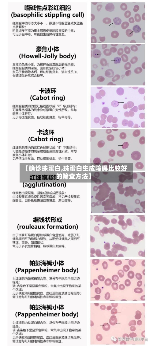 【确诊珠蛋白,珠蛋白生成障碍比较好的筛查方法】