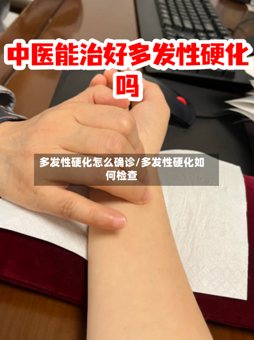 多发性硬化怎么确诊/多发性硬化如何检查