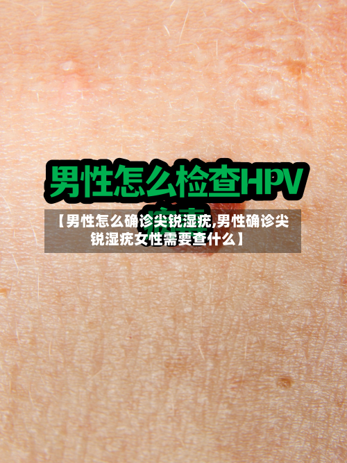 【男性怎么确诊尖锐湿疣,男性确诊尖锐湿疣女性需要查什么】-第2张图片