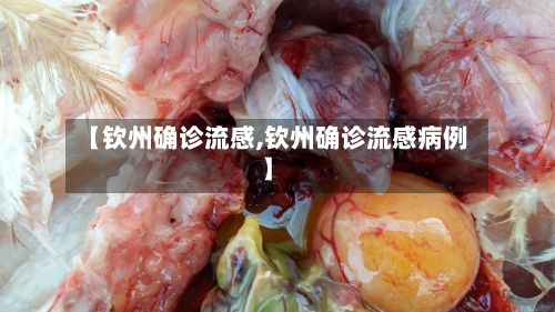 【钦州确诊流感,钦州确诊流感病例】