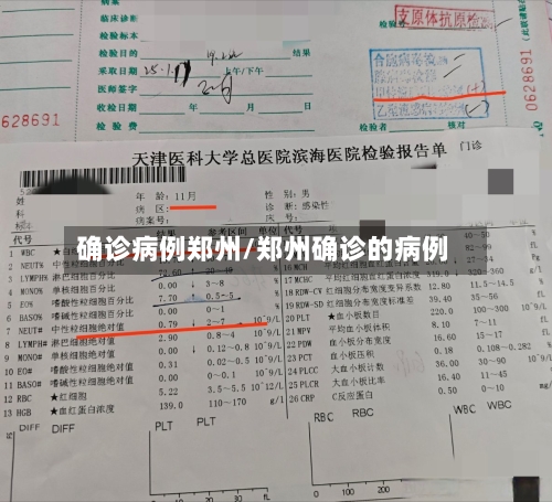确诊病例郑州/郑州确诊的病例