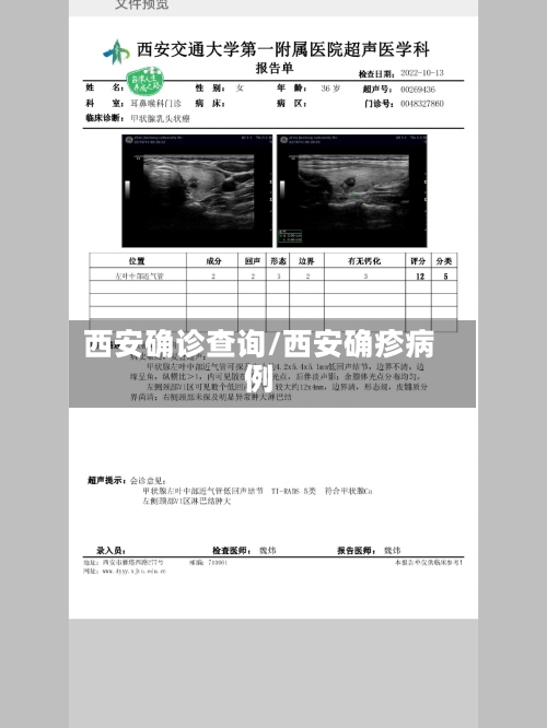 西安确诊查询/西安确疹病例