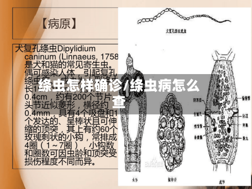 绦虫怎样确诊/绦虫病怎么查