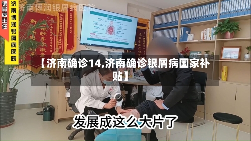 【济南确诊14,济南确诊银屑病国家补贴】-第2张图片