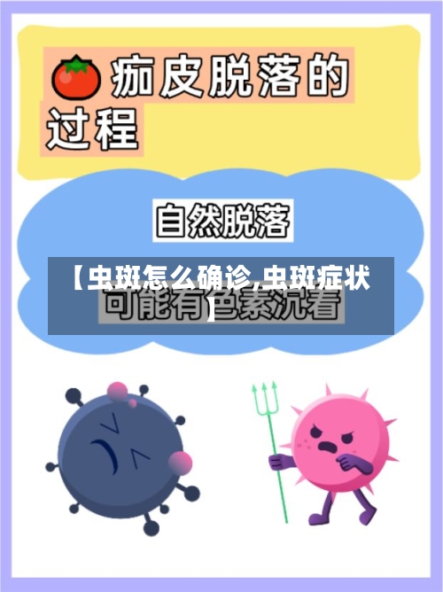 【虫斑怎么确诊,虫斑症状】-第2张图片