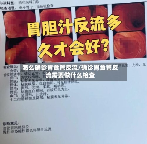 怎么确诊胃食管反流/确诊胃食管反流需要做什么检查-第3张图片