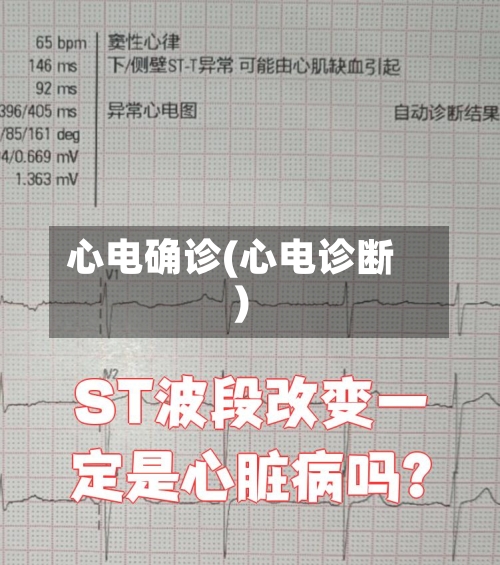 心电确诊(心电诊断)