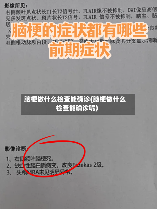 脑梗做什么检查能确诊(脑梗做什么检查能确诊呢)-第3张图片
