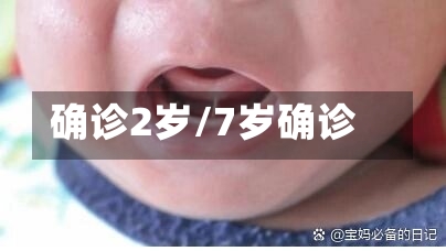 确诊2岁/7岁确诊
