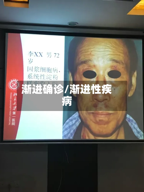 渐进确诊/渐进性疾病-第2张图片