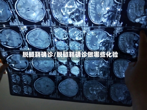 脱髓鞘确诊/脱髓鞘确诊做哪些化验