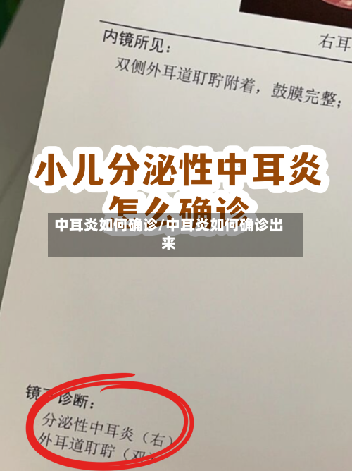 中耳炎如何确诊/中耳炎如何确诊出来-第2张图片