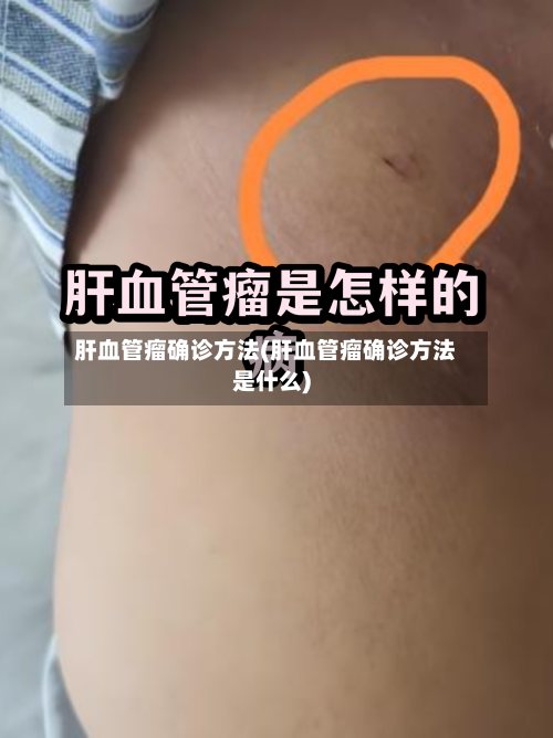 肝血管瘤确诊方法(肝血管瘤确诊方法是什么)-第2张图片