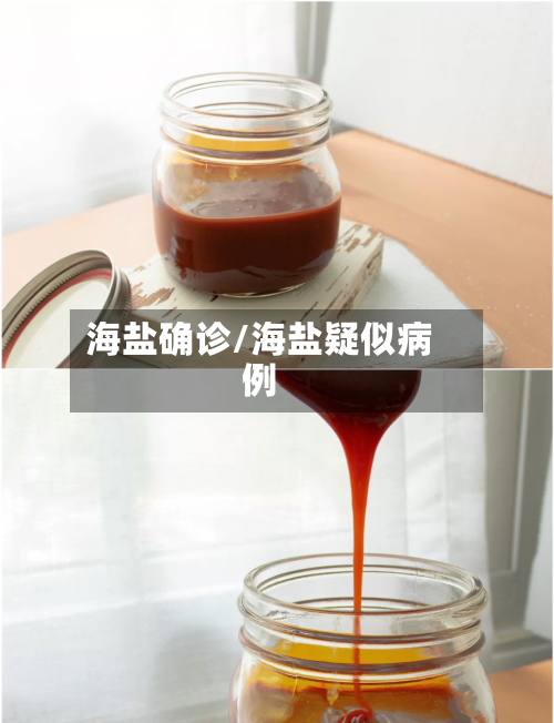 海盐确诊/海盐疑似病例-第2张图片