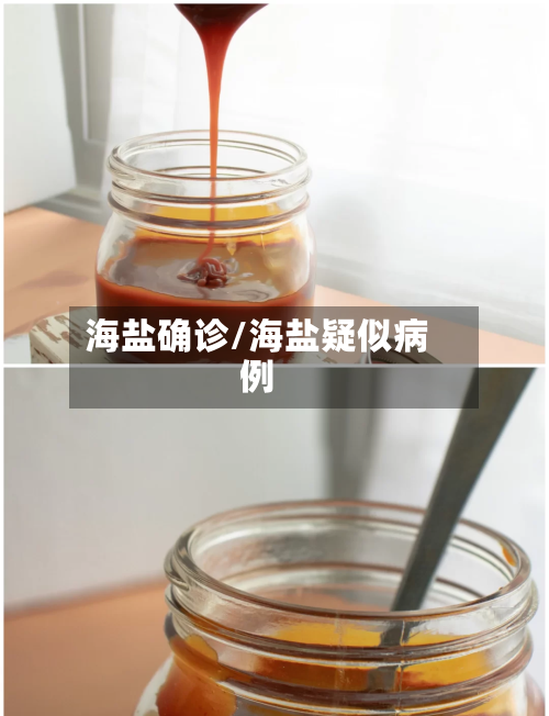 海盐确诊/海盐疑似病例