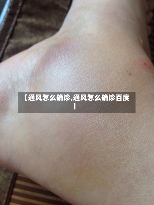 【通风怎么确诊,通风怎么确诊百度】-第2张图片