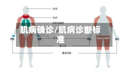 肌病确诊/肌病诊断标准