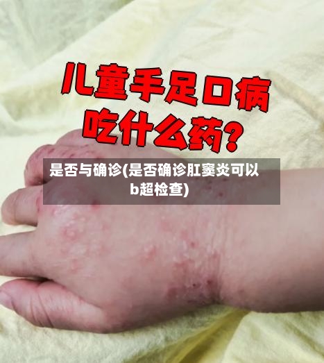 是否与确诊(是否确诊肛窦炎可以b超检查)-第2张图片