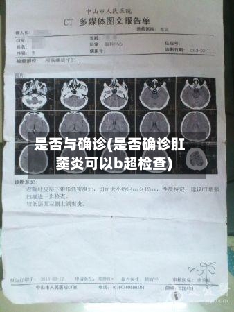 是否与确诊(是否确诊肛窦炎可以b超检查)