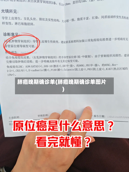 肺癌晚期确诊单(肺癌晚期确诊单图片)