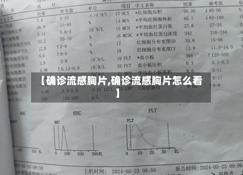 【确诊流感胸片,确诊流感胸片怎么看】