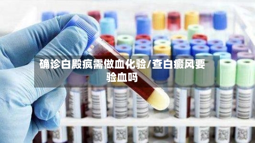 确诊白殿疯需做血化验/查白癜风要验血吗