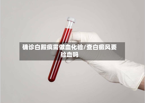 确诊白殿疯需做血化验/查白癜风要验血吗-第3张图片