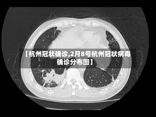 【杭州冠状确诊,2月8号杭州冠状病毒确诊分布图】-第2张图片