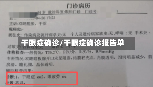 干眼症确诊/干眼症确诊报告单-第2张图片