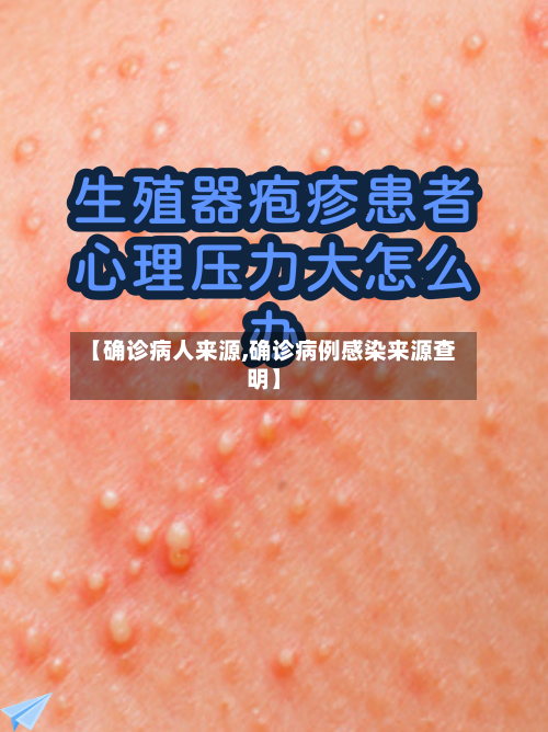 【确诊病人来源,确诊病例感染来源查明】-第2张图片