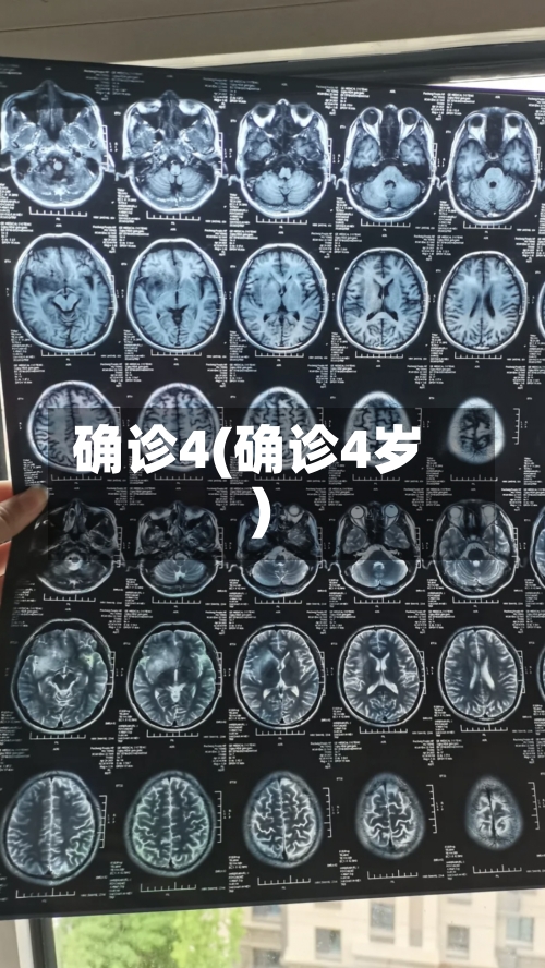 确诊4(确诊4岁)