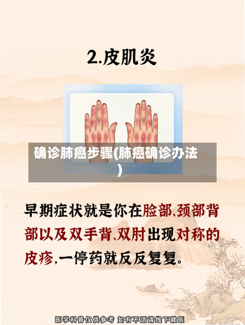 确诊肺癌步骤(肺癌确诊办法)-第2张图片