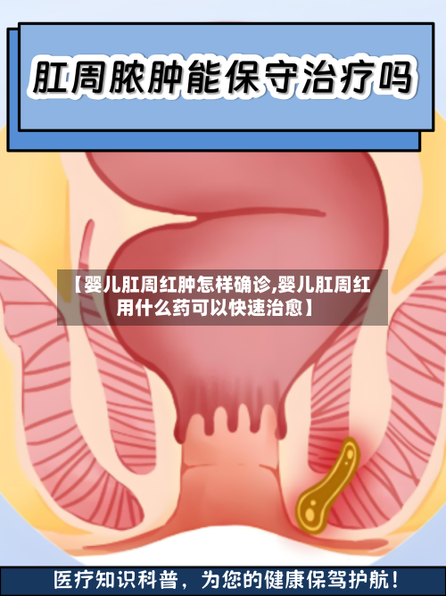 【婴儿肛周红肿怎样确诊,婴儿肛周红用什么药可以快速治愈】