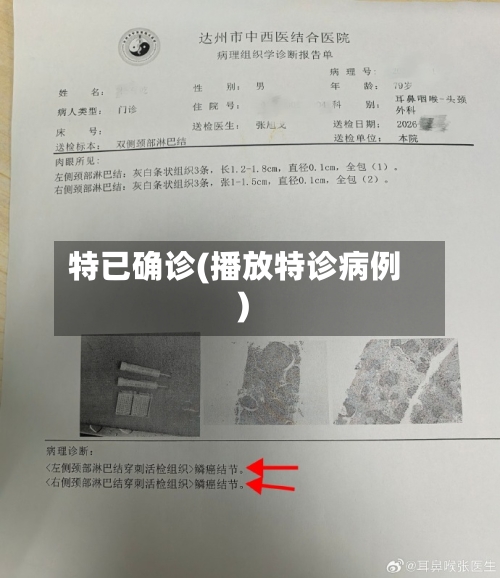 特已确诊(播放特诊病例)-第3张图片
