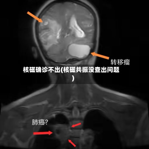 核磁确诊不出(核磁共振没查出问题)-第2张图片