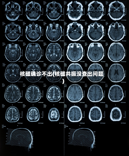 核磁确诊不出(核磁共振没查出问题)