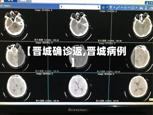 【晋城确诊返,晋城病例】-第3张图片