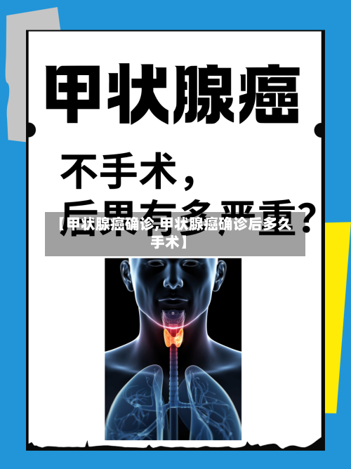 【甲状腺癌确诊,甲状腺癌确诊后多久手术】